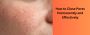 Discover Permanent Solutions to Close Pores