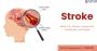Stroke: What It Is, Causes, Symptoms, Treatment, and Types