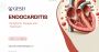 Endocarditis: Causes, Symptoms, and Treatment