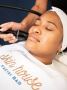 Renew Your Skin’s Glow with RF Microneedling