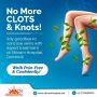 Best Laser Treatment for Varicose Veins