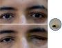 Artificial Eye