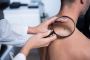 Botox Clinic Sun City Center FL