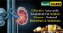 Ayurvedic Treatment for Kidney Stone – Natural Remedies & So