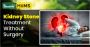Kidney Stone Treatment Without Surgery | Ayurvedic & Natural