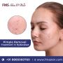 Best Pimple Treatment in Hyderabad | FMS Skin & Hair Clinic