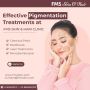 Best Pigmentation Treatments in Hyderabad