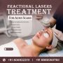Advanced Fractional Laser Therapy for Acne Scars – Say Goodb