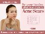 Effective Acne Scar Treatments for Radiant, Smooth Skin