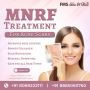 Advanced MNRF Treatment for Acne Scars in Hyderabad
