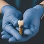 Affordable & Best Conical Abutments Available Now