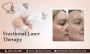 Exploring Fractional Laser Therapy in Staten Island,New York