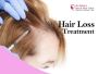 Best Hair Loss Treatment in Marathahalli, Bangalore