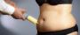 Get Perfect Contours:Best Liposuction Surgery in Chandigarh