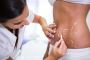 Stretch Mark Removal by Dermatologists for Smooth Skin