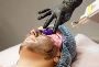 Carbon Facial Treatment in Indore  Advanced Care for Oily