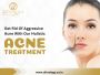 Laser Acne Scar Treatment in Indore for Smooth skin