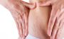 Best stretch marks treatment in Delhi - Solutions for Smooth