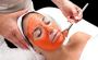 Photofacial Treatment in Delhi - Skinology