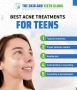 Best Acne Treatments for Teens – Clear Skin Starts Here