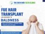FUE Hair Transplant: Say Goodbye to Baldness with Our Afford