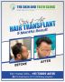 Regain Your Confidence with Hair Restoration Treatment