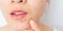 Acne Scar Treatment In Gurgaon