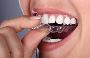 Invisalign Treatment in Mumbai | Clear Alignment in Mumbai 
