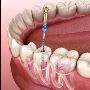 Best Dentist in Mahim East for Root Canal