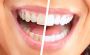 Teeth Whitening Hampshire