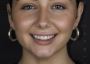 Your Perfect Smile: Cosmetic Dentistry in North London and T