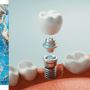 Restore Your Smile with Dental Implants in Columbia, SC