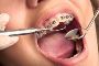 Metal Braces in Chelsea | Cost-Effective Orthodontics