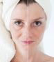 Chemical Peels Treatment Near Virginia | Lifestyle’s MedSpa