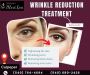 Wrinkle Treatment in Warrenton | Lifestyle’s MedSpa