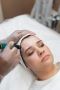 Looking for Safe & Effective Microneedling in Norfolk, VA?