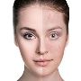Laser Genesis Skin Therapy