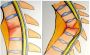 Slip Disc Treatment in Vizag | Sciatica Treatment in Vizag