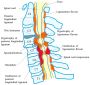 Cervical Spine Surgery  by Dr. B. Leela Prasad