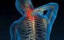 Cervical Spondylitis & Neck Pain Treatment in India