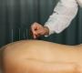 Effective Acupuncture for Anxiety Relief