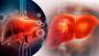 Can Fatty Liver Disease Lead to Cirrhosis?