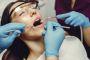 Root Canal Treatment in Dubai