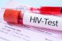 HIV Prevention: How Early Detection Helps