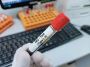 Where to Get an Accurate HIV Test in Dubai 