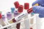 Reliable STD Test at Home Dubai – Private & Hassle-Free