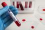 STD Testing Information Dubai 2025