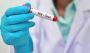 Book a Confidential HIV Test in Dubai