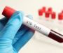 Affordable STD Test in Dubai