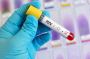 Your Privacy Matters – HIV Test Options in Dubai